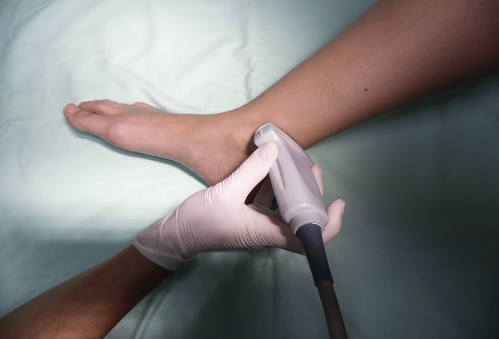 anestesia tibial posterior